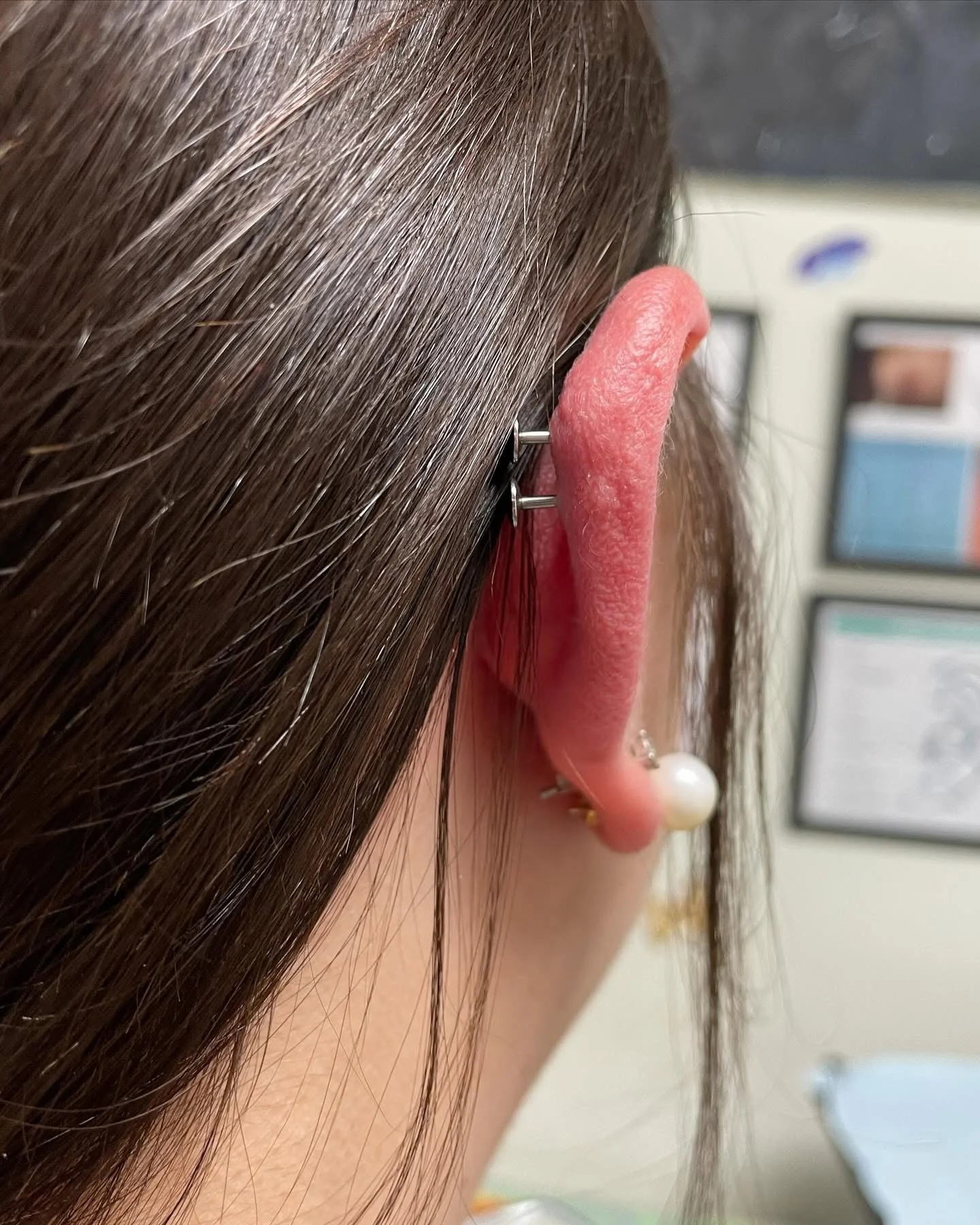 Back of a dbl helix — helix piercing